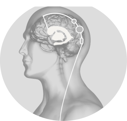 sphera-duo-sant-sistemleri-3.png